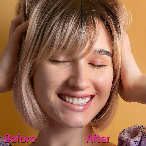 OxyGlow 2 Cordless High Frequency Facial Wand Face and Scalp
