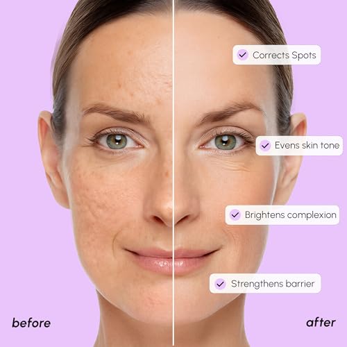 Tranexamic Acid Serum