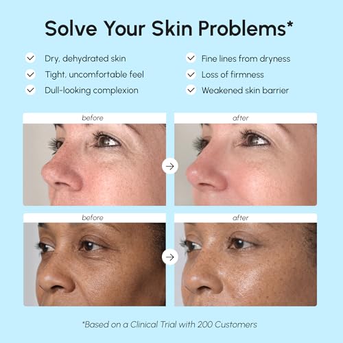 Face Moisturizer