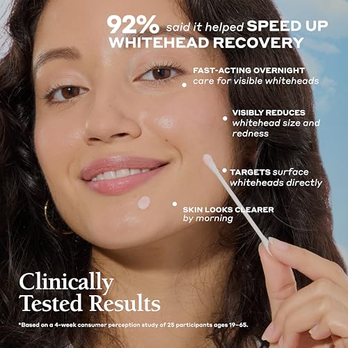 Drying Lotion for All Skin Types| Blemish Spot Treatment with Salicylic Acid and Sulfur |