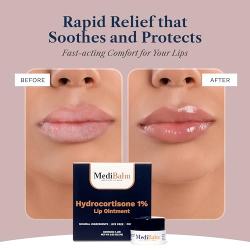 for Dry Cracked Lips - Healing Lip Balm for Severely Chapped Lips - Designed for Men
