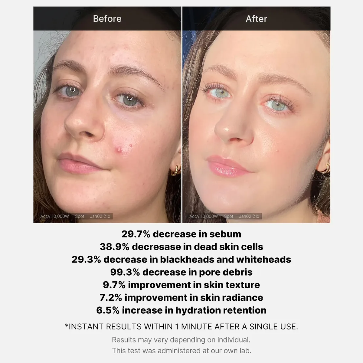 Acid Wash-off Exfoliant