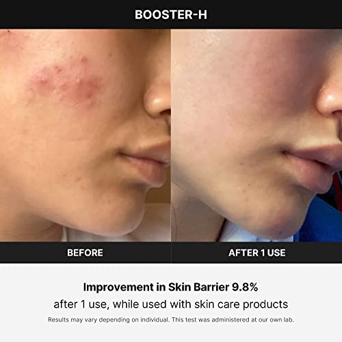 Booster H