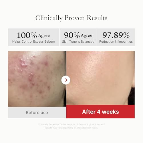 Clarifying Pad & Soothing Cream Duo - Succinic Acid Pad & 3H Cream