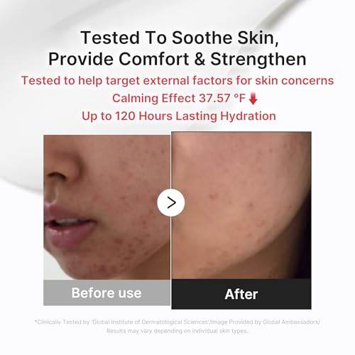 Clarifying Pad & Soothing Cream Duo - Succinic Acid Pad & 3H Cream