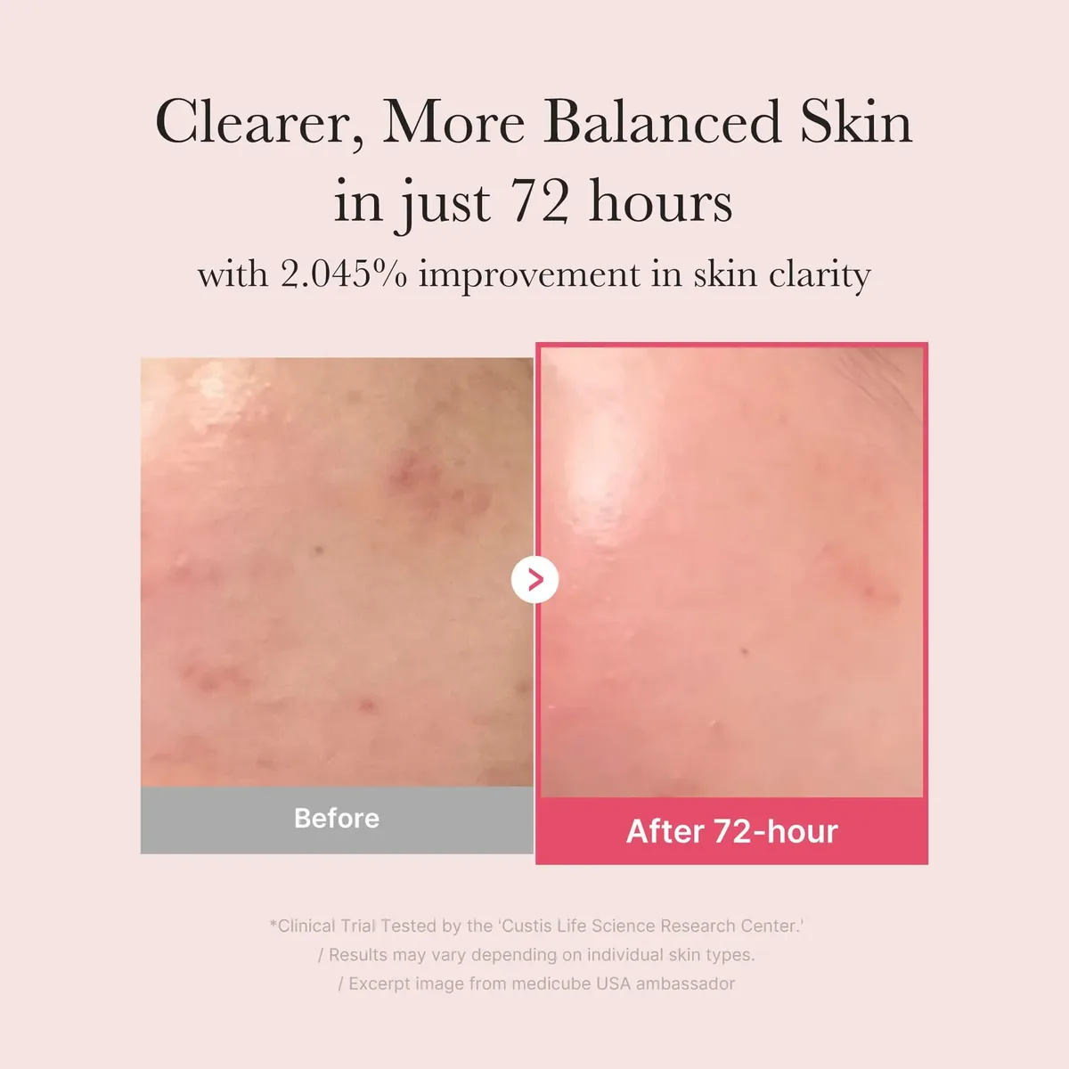 Clear Skin Serum Duo