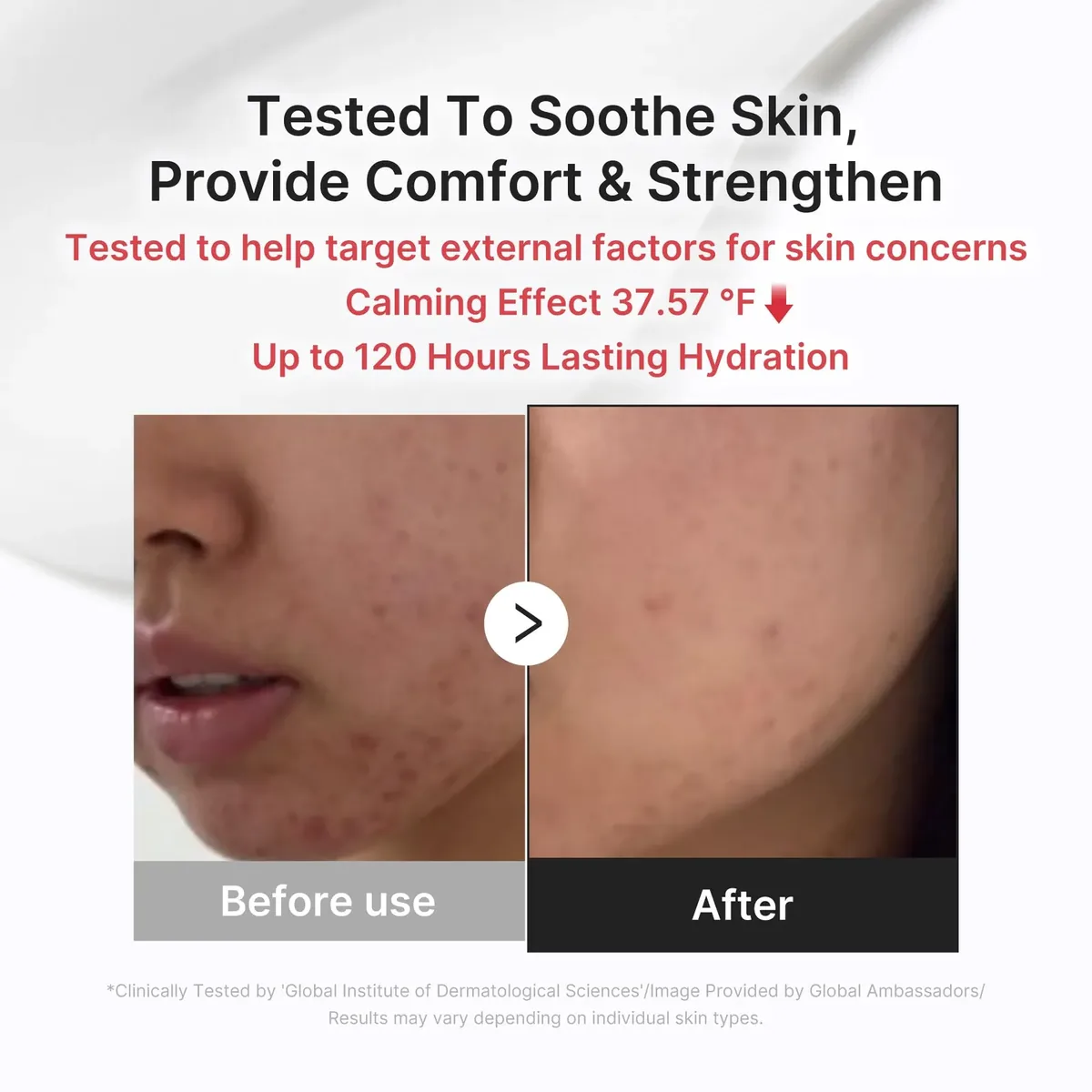Daily Relief Cream
