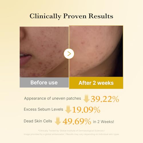 Kojic Acid Renew & Smooth Duo - Kojic Acid Serum and Toner Pad
