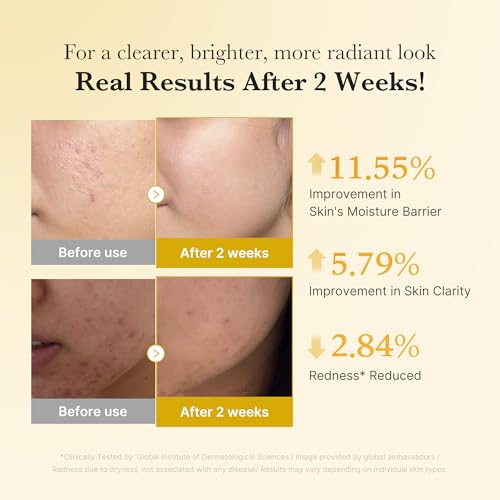 Kojic Acid Renew & Smooth Duo - Kojic Acid Serum and Toner Pad