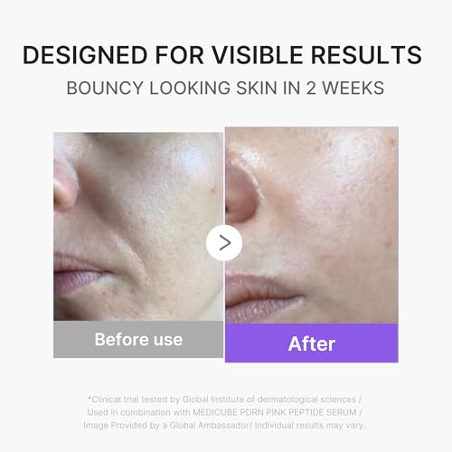 Mini Booster Pro Plus Full Facial Device Set - Glow Boost