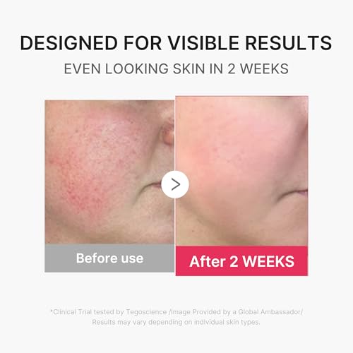 Mini Booster Pro Plus - Portable Facial Device for Radiance