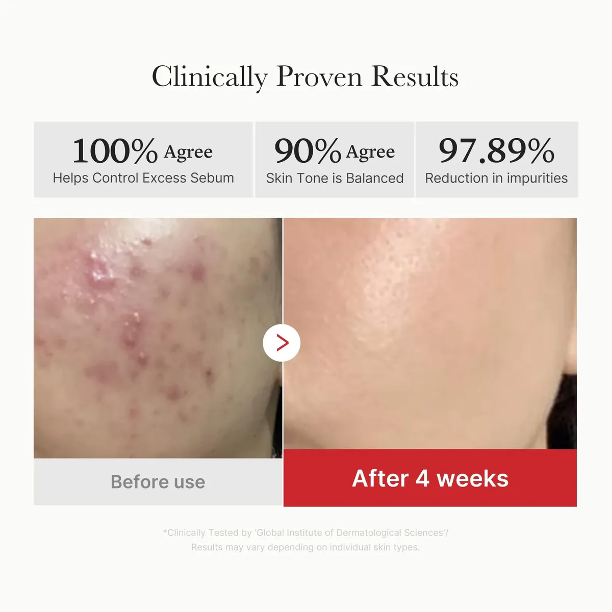 Succinic Acid Toner Pads