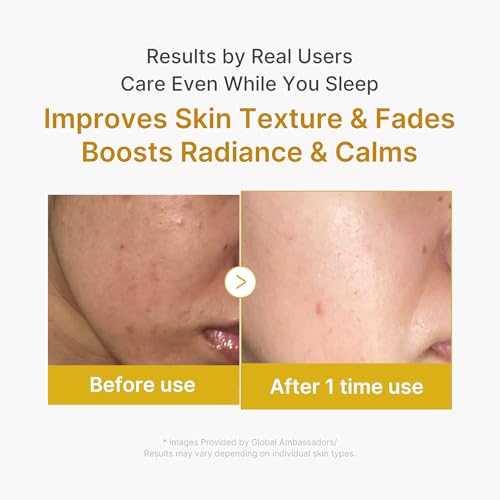 Vitamin C Moisturizer & Turmeric Mask