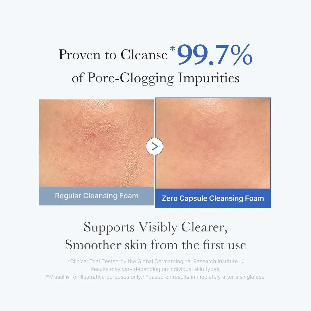 Zero Pore Clear Blue Capsule Facial Deep Cleanser