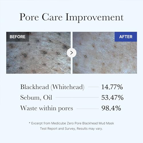 Zero Pore Mud Mask & Brush Set for Pore Care
