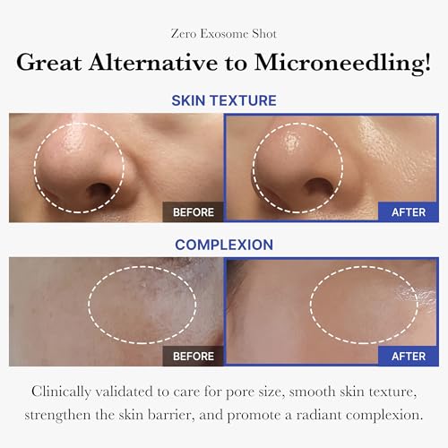 Zero Pore Set - Zero Pore Pads & Exosome Shot 2