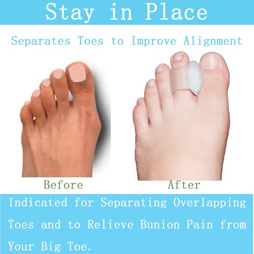 Pack of 12 Gel Toe Separator