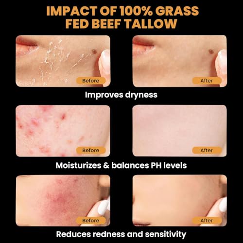 Beef Tallow and Honey Balm for Skin and Face
