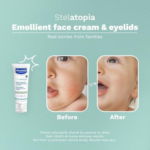 Stelatopia Emollient Face Cream