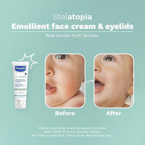 Stelatopia Emollient Face Cream