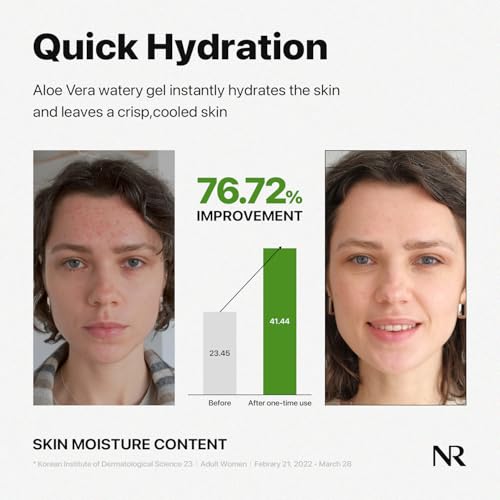 Mild & Moisture Aloe Vera Watery Gel (Tube)