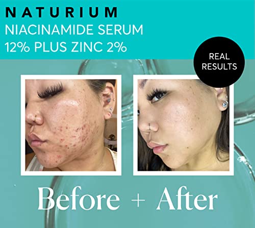 Niacinamide Serum 12% Plus Zinc 2%