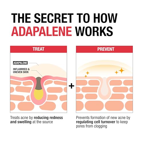 Adapalene Gel 0.1%
