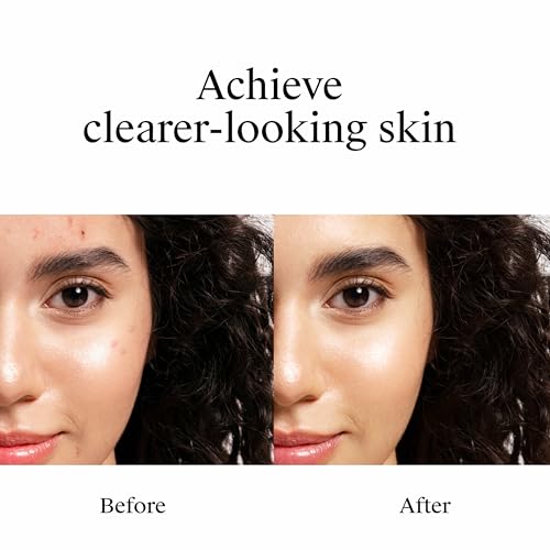 Rapid Clear Stubborn Acne 10% Benzoyl Peroxide