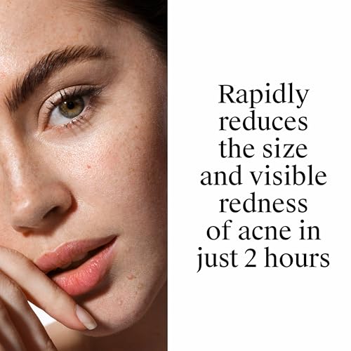 Rapid Clear Stubborn Acne 10% Benzoyl Peroxide