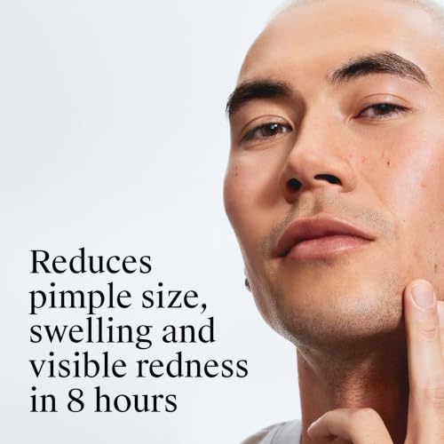 Rapid Clear SA Acne Pads