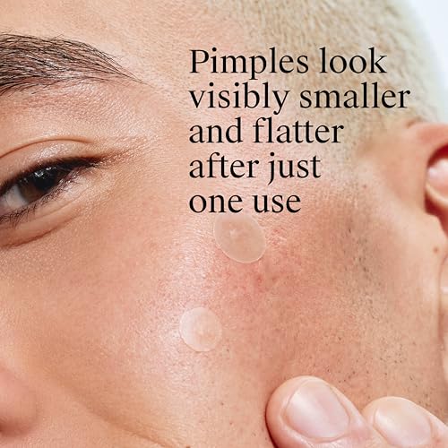 Stubborn Acne Patches Ultra-Thin 24 Ct