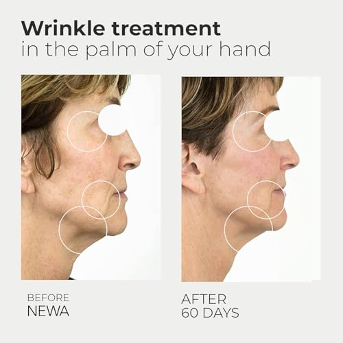 RF Wrinkle Reduction Device Plug in FDA Cleared Facial Tightening