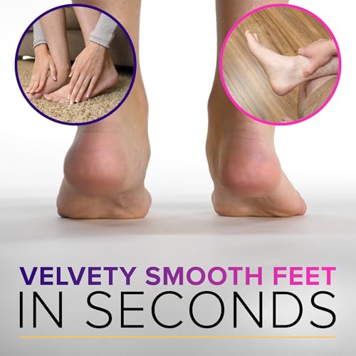 RUSTPROOF Foot File Callus Remover for Feet with Catcher | XL Size