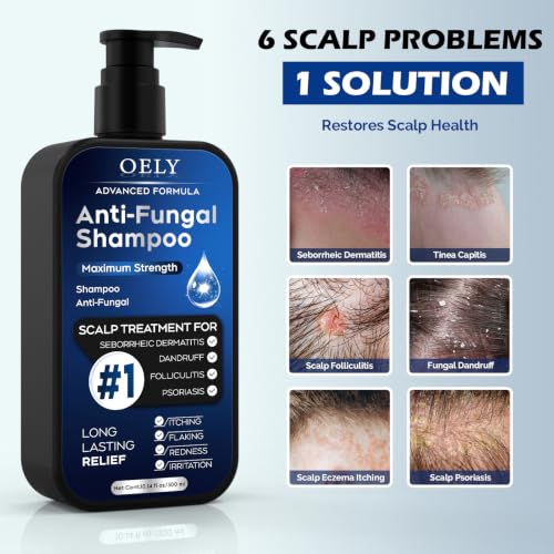 Antifungal Shampoo for Seborrheic Dermatitis, Folliculitis