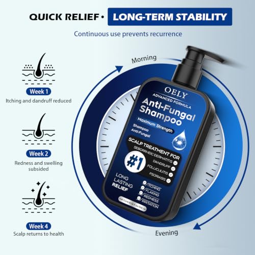 Antifungal Shampoo for Seborrheic Dermatitis, Folliculitis