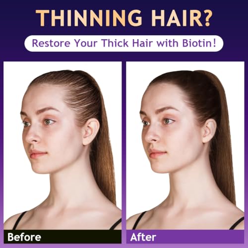 Hair Loss Shampoo for Thinning Hair-Fresh