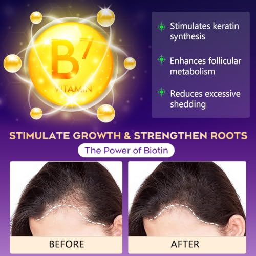 Hair Loss Shampoo for Thinning Hair-Fresh