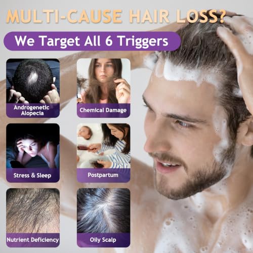 Hair Loss Shampoo for Thinning Hair-Fresh
