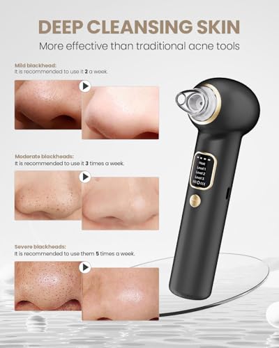 Heated Blackhead Remover Pore Vacuum 5 Probes 3 Suction Modes