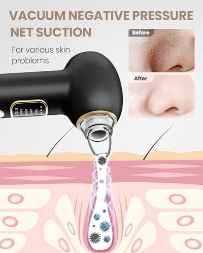Heated Blackhead Remover Pore Vacuum 5 Probes 3 Suction Modes