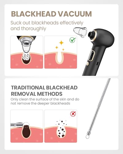 Heated Blackhead Remover Pore Vacuum 5 Probes 3 Suction Modes