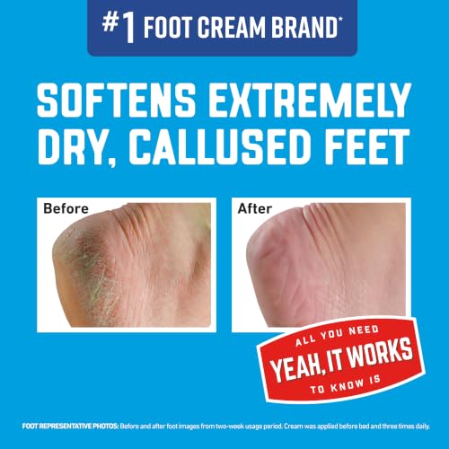 ealthy Feet Intense Renewal Cream, 3 oz Tube, 1-Pack