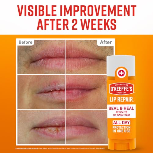 Lip Repair Seal & Heal Medicated Lip Balm