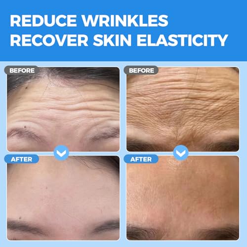 Forehead Wrinkle Patches Overnight 20 pcs with Collagen