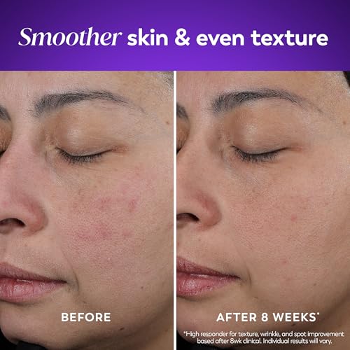 Retinol Night Cream for Women, Anti-Aging Face Moisturizer, Fragrance-Free, Non Greasy