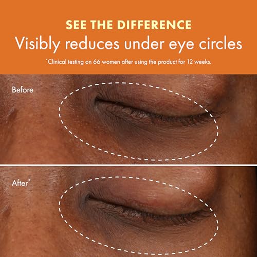 GinZing Brightening Eye Cream