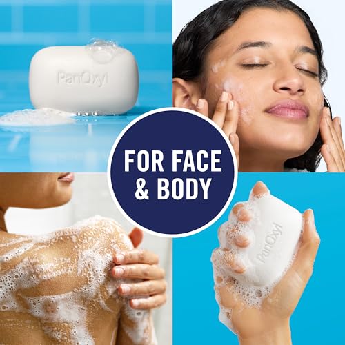Acne Cleansing Bar, 2% Salicylic Acid, For Face & Body