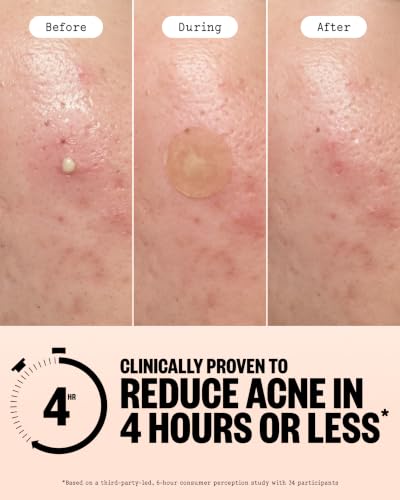 Acne Healing Dots Medicated Hydrocolloid 40 ct