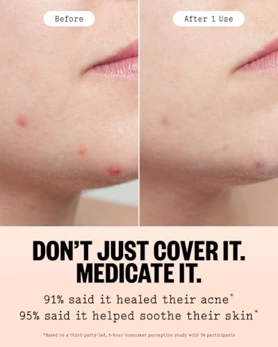 Acne Healing Dots Medicated Hydrocolloid 40 ct