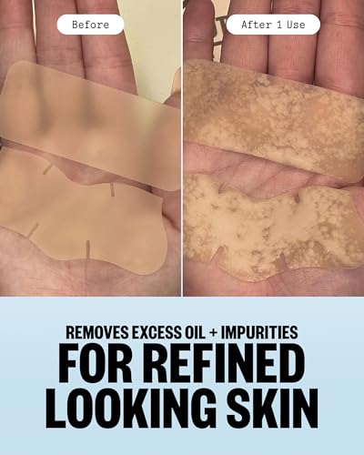 Pore Minimizing Hydrocolloid Strips